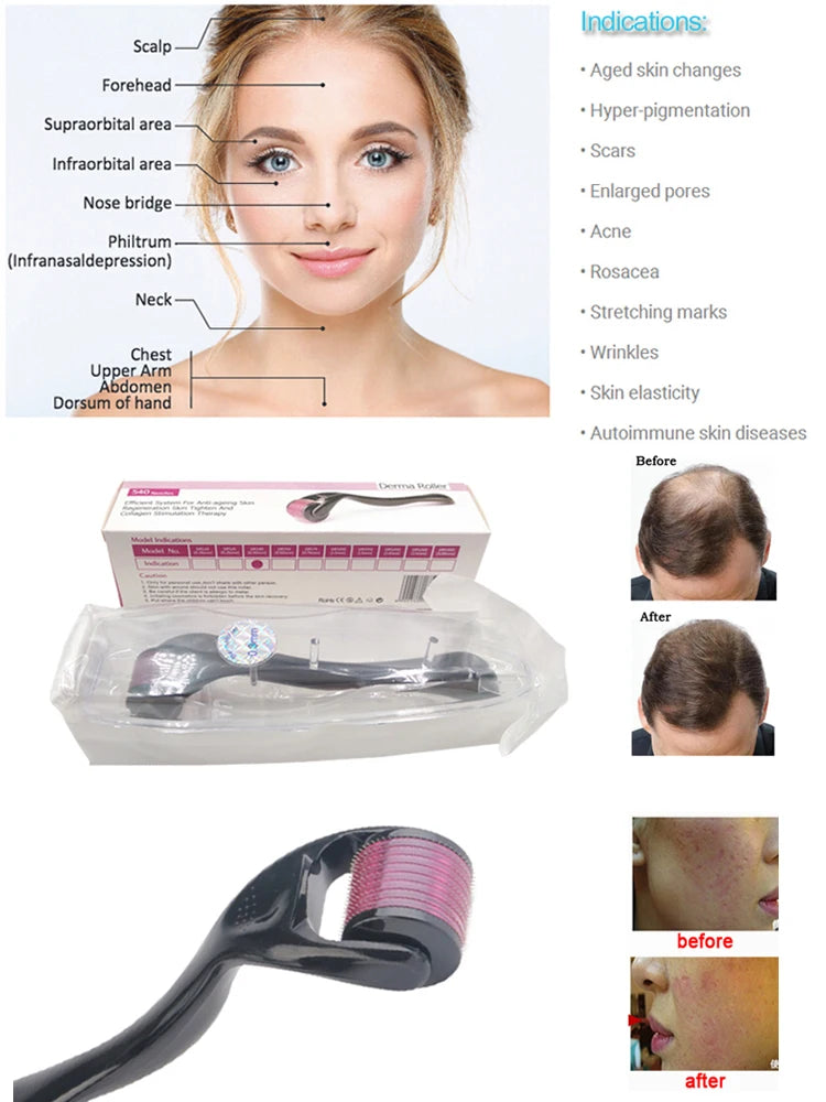 Derma Roller  Needle Skin Care Treatment Scalp
