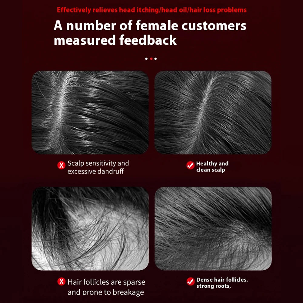 Electric Vibration Scalp Massager & Advanced Red Light Hair Growth Brush