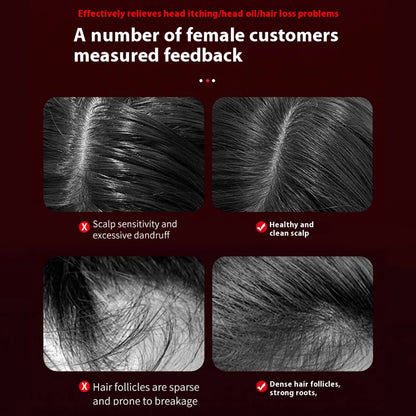 Electric Vibration Scalp Massager & Advanced Red Light Hair Growth Brush