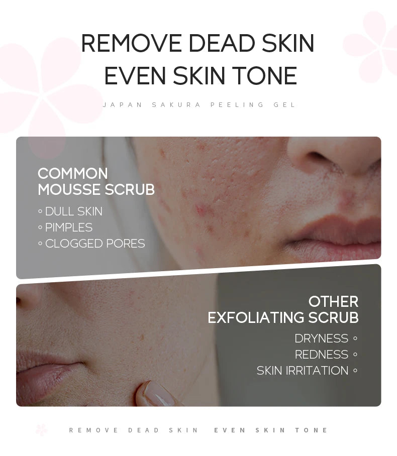 LAIKOU Japan Sakura Peeling Gel Gentle Exfoliating Dead Skin Remover Brightening Face Scrub